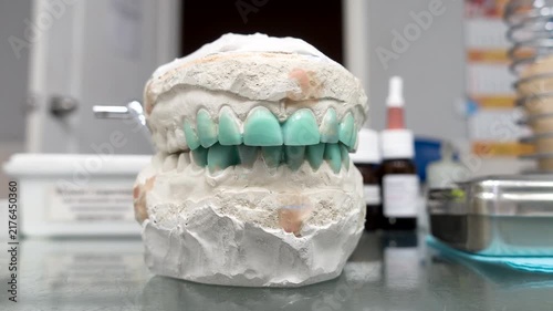 modeling of artificial teeth on a plaster model