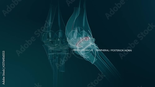Animating 3D knee joint, drawing guide arc, rotating and labeling medial meniscus horn to highlight