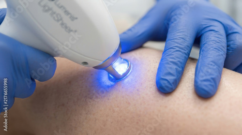 Close-up of Laser Depilation Device on Skin
