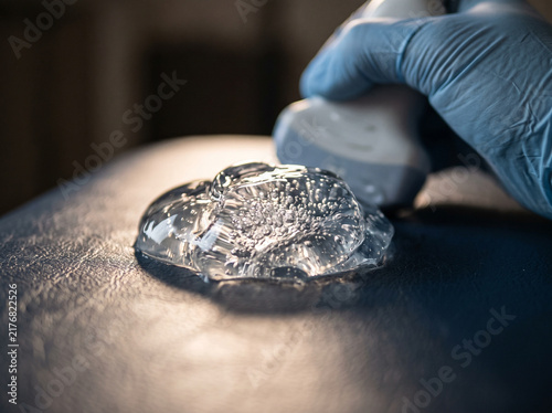 Obraz na płótnie Ultrasound Transmission Contact Gel Droplet on Transducer Probe Surface
