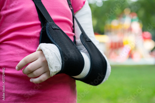 Bild auf Leinwand Close up girl arm, bone fracture in cast and sling