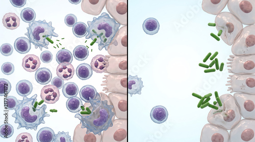 Healthy Immune System vs Weakened Immune Defense Medical Comparison
