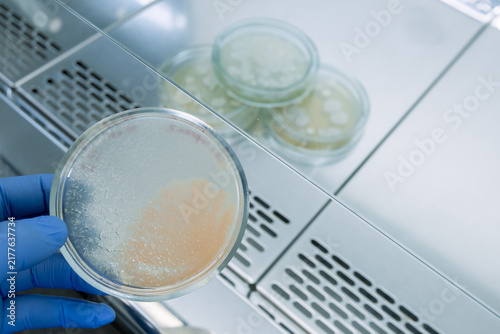 Analysis of a colony of pink-colored bacteria in a petra dish in laboratory conditions under aseptic conditions, in the background are other Petri dishes.