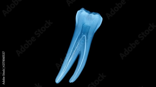 Detailed Dental X-ray Image of a Tooth Root Structure Against a Dark Background