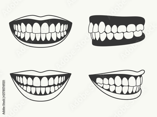Set of dental smile illustrations showing human teeth from front and side perspectives in black line art.