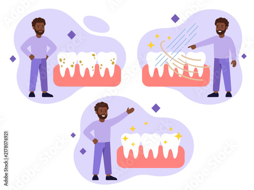 Dental Cleaning and Teeth Whitening Stages Illustration with Black Man