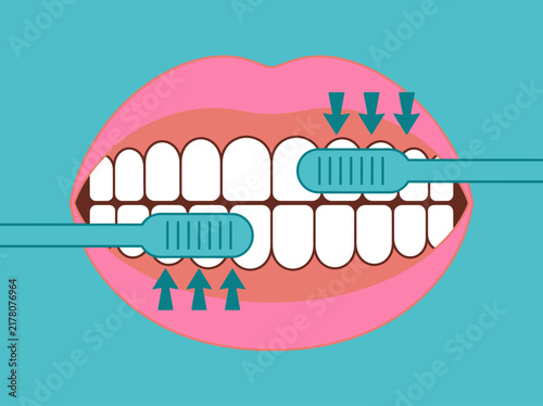 Dental Hygiene Illustration Showing Correct Tooth Brushing Technique for Healthy Gums and White Teeth