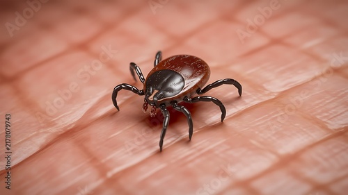 Closeup of a tick attached to human skin showing parasite infestation and health risk