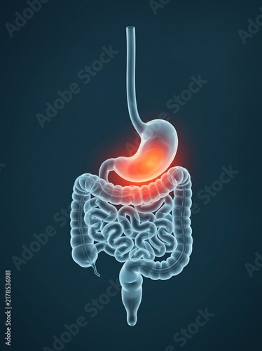 Stomach pain human anatomy 3d medical illustration