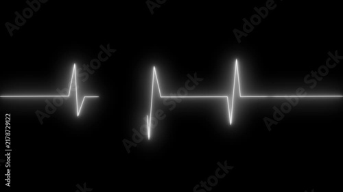 Bright ECG heartbeat waveform on dark grid background animation, glowing pulse line across monitor