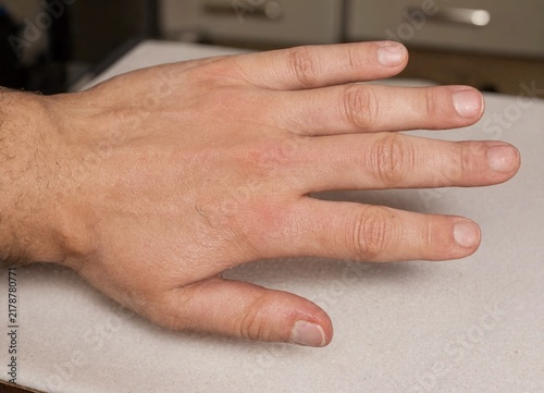 Detailed view of a Caucasian male hand with fingers extended and palm visible showing skin texture