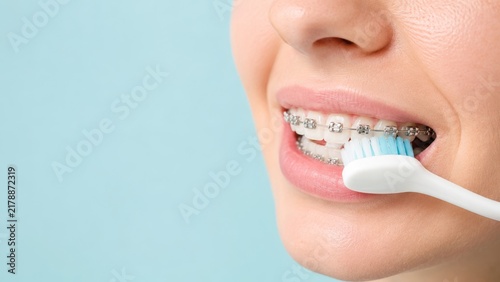 Woman brushing teeth with metal braces using toothbrush. Dental care and oral hygiene during orthodontic treatment. Healthy smile and teeth alignment concept for stomatology clinic