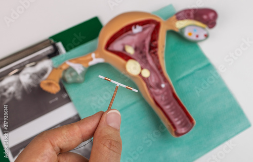 Fotografía Copper intrauterine device held in front of uterus model for contraception