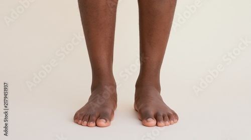 Brown legs. Two legs of Brown individual