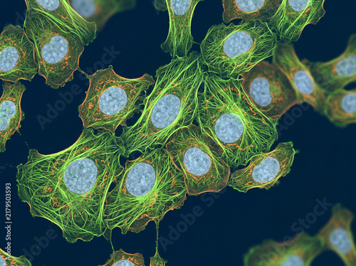 Fibroblast cells linked by glowing green filaments on a dark blue field