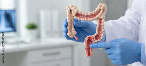 Doctor in blue gloves holding anatomical model of human intestine and pointing at rectum. Hemorrhoid and colon disease diagnosis concept. Gastroenterology, proctology medicine and healthcare education