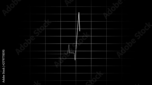 Glowing white heartbeat line on dark monitor screen medical technology data visualization abstract health science background animation loop. 4K 
