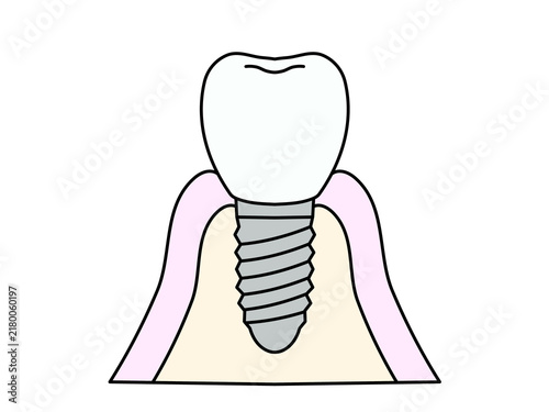 illustration of a tooth