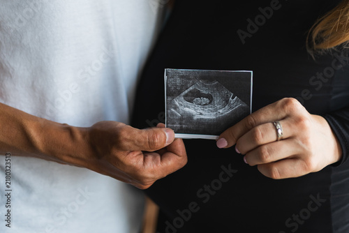 Fotografía Couple holding ultrasound scan image of future baby expecting child