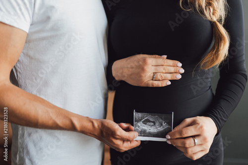 Fotografía Expectant parents holding baby ultrasound picture close to pregnant belly