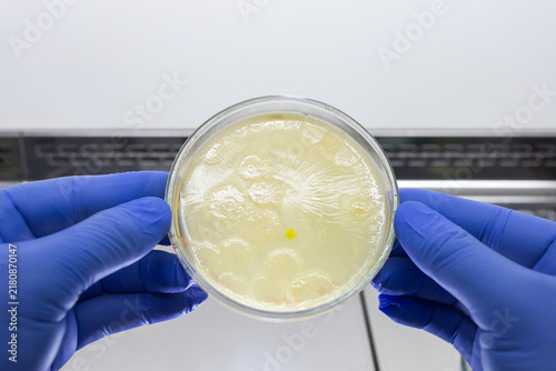 Canvastavla A scientist holds a large petri dish containing identical colonies of bacteria with both gloved hands