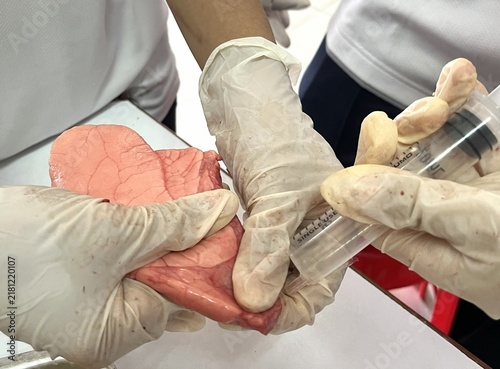 Fotografía Lungs dissection