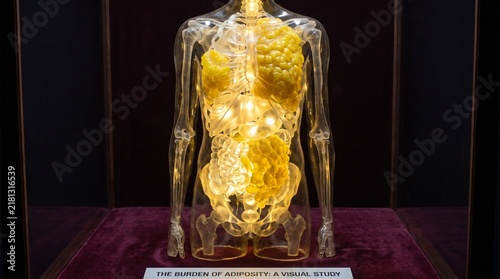Transparent human anatomical model showing fat deposits in display