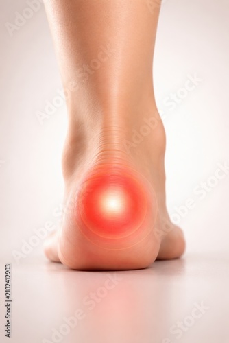 Close-up of a human foot with a highlighted area on the heel indicating pain or discomfort against a neutral background