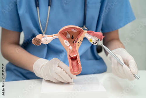Fotografía Uterus, doctor holding human anatomy model for study diagnosis and treatment in hospital