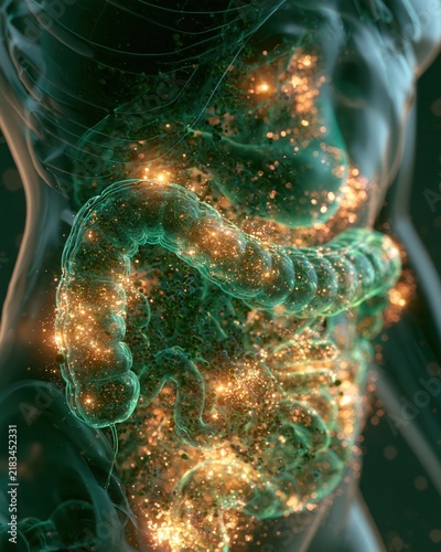 intestinal dysbacteriosis