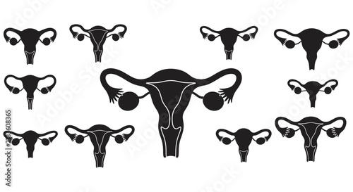 Collection of uterine silhouettes against a white background anatomical illustration