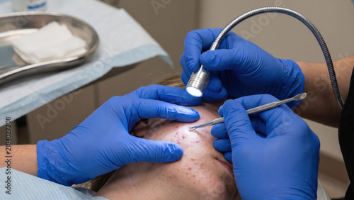 Clinician Examining Skin Lesion Characteristics Under Clinical Light for Acne Diagnosis