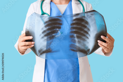 Female doctor with x-ray image of lungs on blue background, closeup