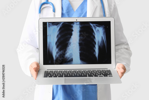 Female doctor holding laptop with x-ray image of lungs on white background, c...