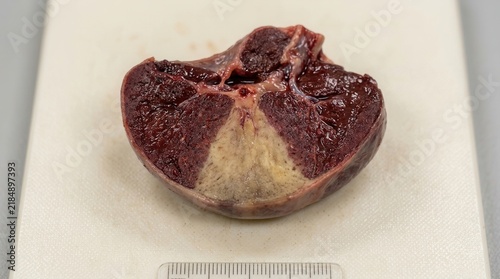 Medical Specimen Cross Section With Textured Internal Detail