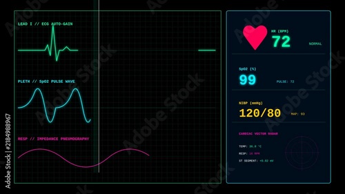 Digital Medical Patient Monitor Screen Display Showing Vital Signs and Heart Rate Pulse Wave Data