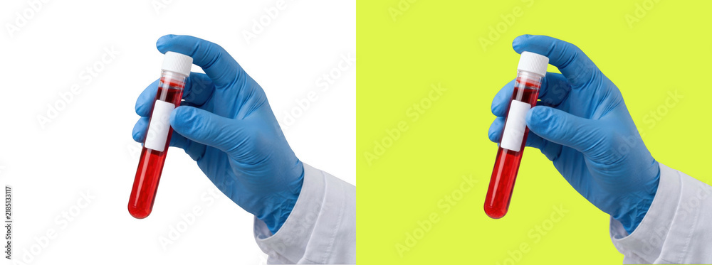 image to crop