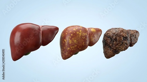 Three stages of human liver