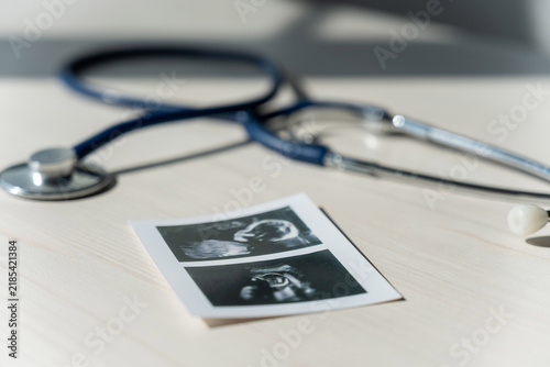 Foto Photo: Ultrasound screening of a child and stethoscope