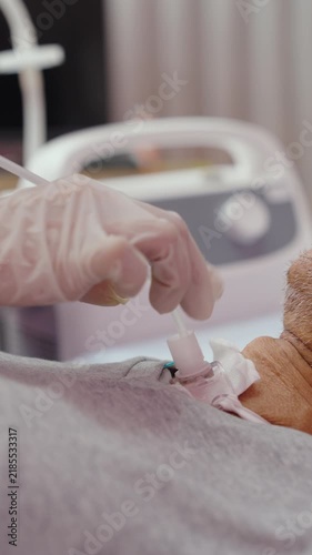Close-up Hand of nurse suctions mucus from a tube in the throat of a patient who had a tracheostomy and is recovering at home