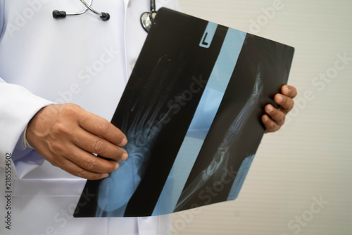 Foto Doctor examining foot ankle  joint bone radiography xray film.
