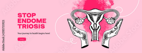Trendy collage with sketch uterus. Stop endometriosis concept. Care of female health, fertility, reproductive system. Gynecological design poster for woman. Hand drawn vector illustration