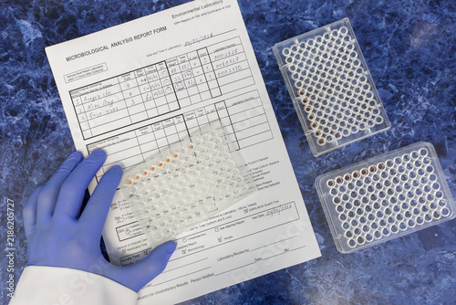 Quadro su tela The scientist placed an immunological plate containing antibody reactions onto the laboratory protocol; additional plates lay on the table nearby