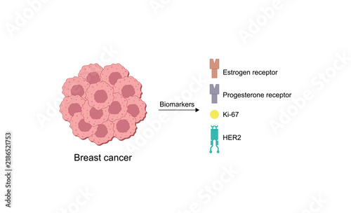 Breast cancer biomarkers, including estrogen receptors, progesterone receptors, Ki-67 and HER2. Vector illustration.