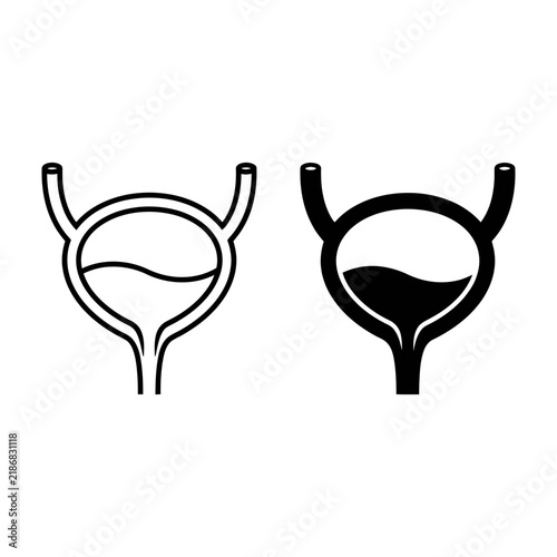 Medical illustration of uterus shapes