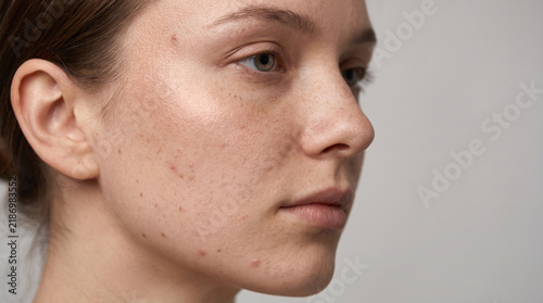 Woman showing natural skin texture with freckles and subtle blemishes under soft studio light.