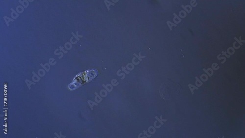 Micro organism - ciliate swimming