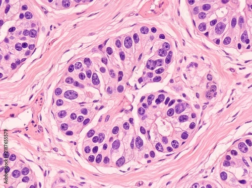 Microscopic view of human breast glandular tissue showing lobules with epithelial cells during histological examination with pink stroma