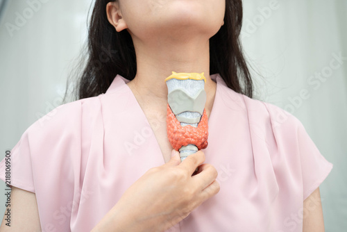 Fotografie Hyperthyroidism, Overactive Thyroid, Thyroid Lymphoma, Asian woman with thyroid gland human anatomy model