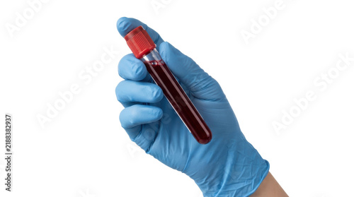 Gloved hand holding test tube with red blood against white background
